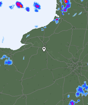 Radar