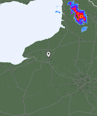 Radar