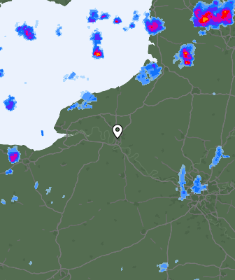 Radar
