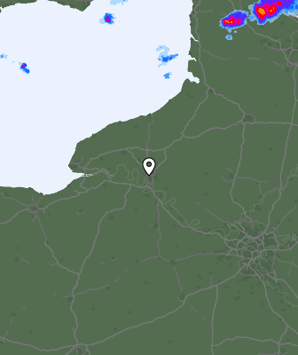 Radar