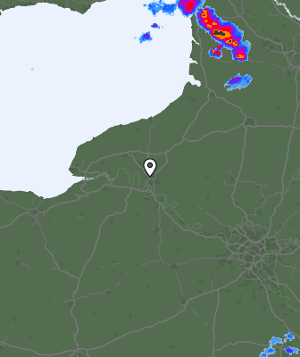 Radar