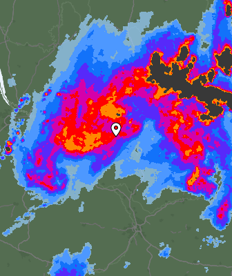 Radar