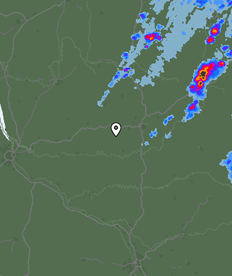 Radar