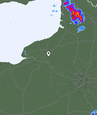 Radar