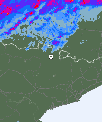 Radar