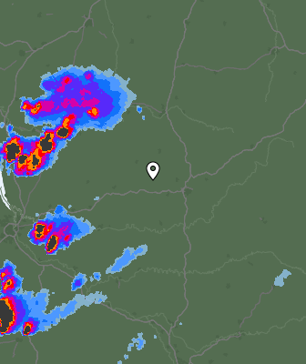 Radar
