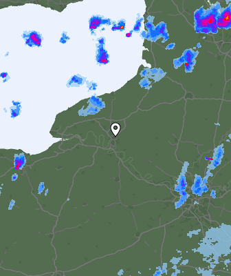 Radar