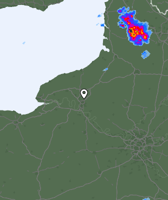 Radar