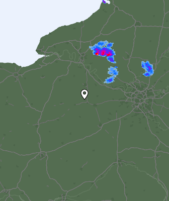 Radar
