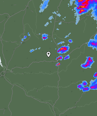 Radar
