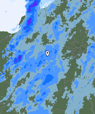 Radar