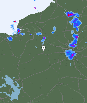Radar