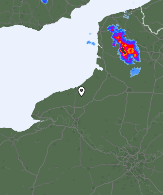 Radar