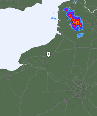 Radar