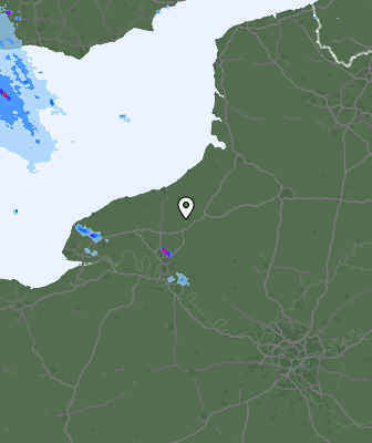 Radar