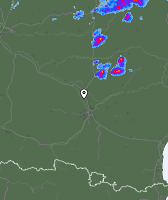 Radar
