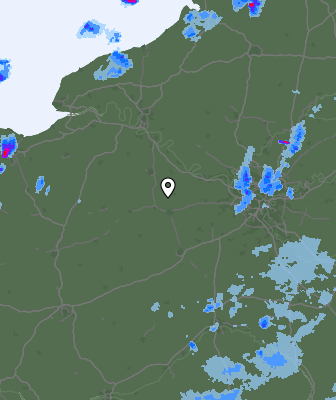 Radar