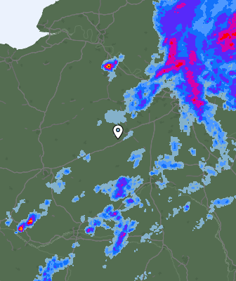 Radar