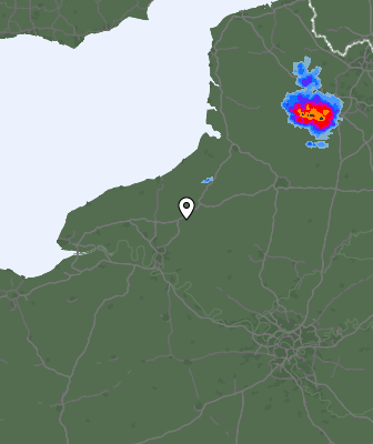 Radar