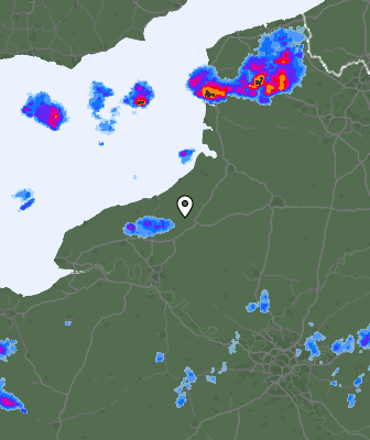 Radar