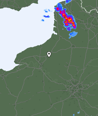 Radar