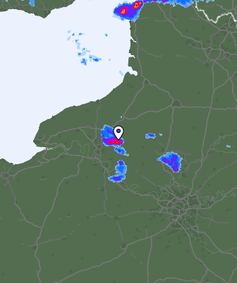 Radar