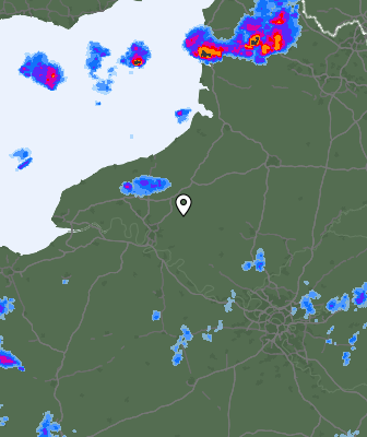Radar
