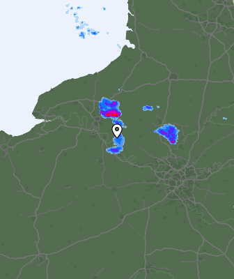Radar