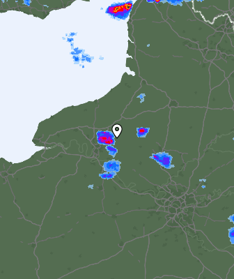 Radar