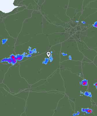 Radar
