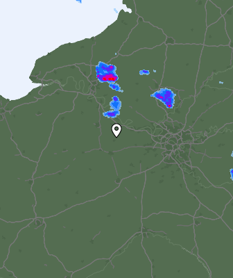 Radar