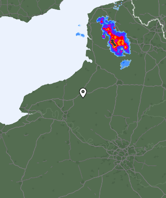 Radar