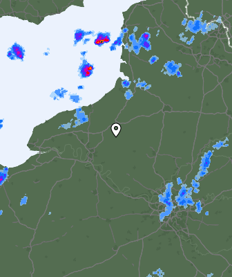 Radar