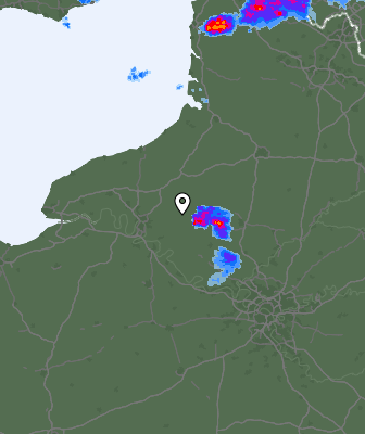 Radar