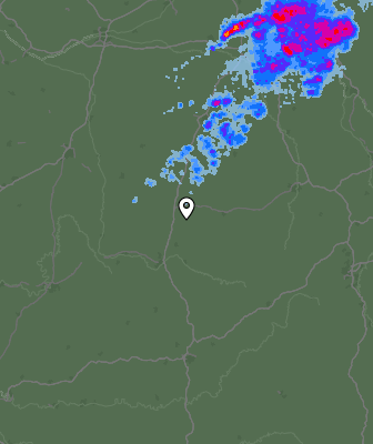 Radar