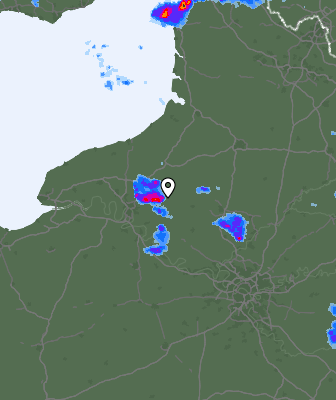 Radar