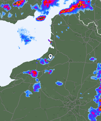 Radar