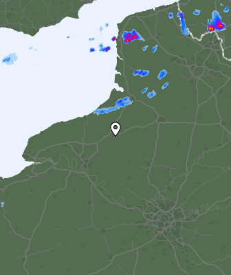 Radar