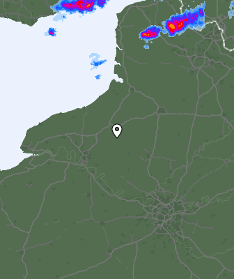 Radar