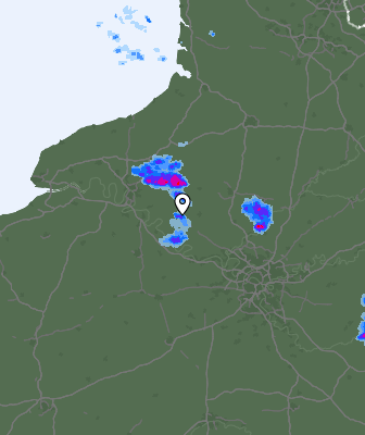 Radar