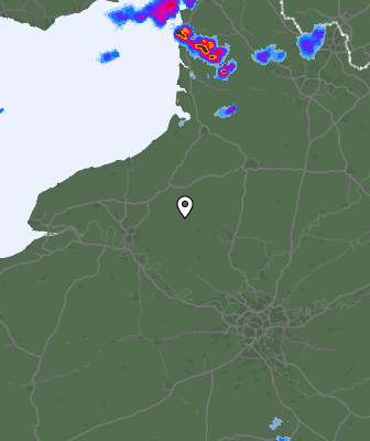 Radar