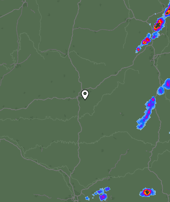 Radar