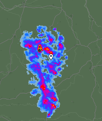 Radar