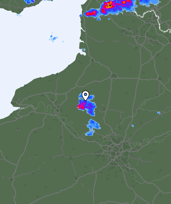 Radar