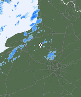 Radar