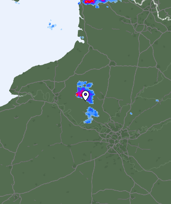Radar