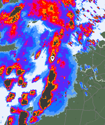 Radar