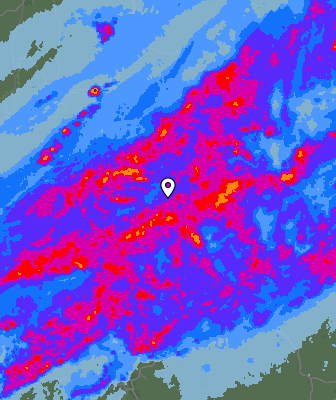 Radar