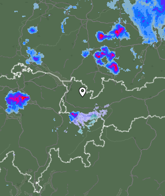 Radar