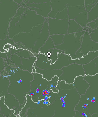 Radar